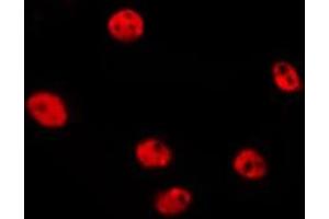 ABIN6277205 staining HepG2 by IF/ICC.