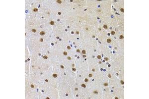 Immunohistochemistry of paraffin-embedded rat brain using PPP1R8 Antibody (ABIN5974046) at dilution of 1/100 (40x lens). (PPP1R8 antibody)