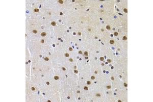 Immunohistochemistry of paraffin-embedded rat brain using PPP1R8 Antibody (ABIN5974046) at dilution of 1/100 (40x lens). (PPP1R8 antibody)