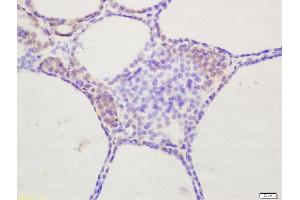 Formalin-fixed and paraffin embedded rat thyroid labeled with Rabbit Anti-TSH Polyclonal Antibody, Unconjugated  at 1:200 followed by conjugation to the secondary antibody and DAB stainin (TSH antibody  (AA 51-138))