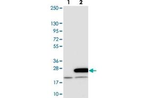 Western blot analysis of Lane 1: Negative control (vector only transfected HEK293T lysate). (MRPL20 antibody)