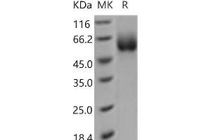 Western Blotting (WB) image for Solute Carrier Family 3 (Activators of Dibasic and Neutral Amino Acid Transport), Member 2 (SLC3A2) protein (His tag) (ABIN7321118) (SLC3A2 Protein (His tag))