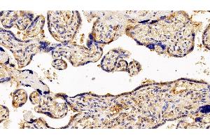 Detection of GCSFR in Human Placenta Tissue using Polyclonal Antibody to Colony Stimulating Factor Receptor, Granulocyte (GCSFR) (CSF3R antibody  (AA 26-138))