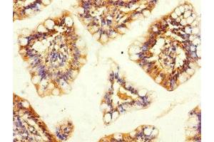 Immunohistochemistry of paraffin-embedded human small intestine tissue using ABIN7170368 at dilution of 1:100 (SNX18 antibody  (AA 449-628))