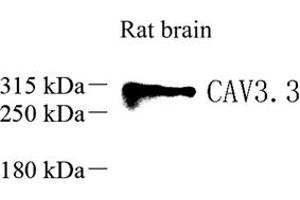 Western blot analysis of Ca(v)3. (CACNA1I antibody)