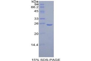 SDS-PAGE (SDS) image for Vitamin D-Binding Protein (GC) (AA 18-211) protein (His tag) (ABIN1099574) (Vitamin D-Binding Protein Protein (GC) (AA 18-211) (His tag))