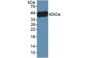 Detection of Recombinant PF4V1, Human using Polyclonal Antibody to Platelet Factor 4 Variant 1 (PF4V1) (PF4V1 antibody  (AA 1-104))