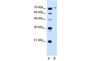 Image no. 1 for anti-Solute Carrier Organic Anion Transporter Family, Member 6A1 (SLCO6A1) (AA 101-150) antibody (ABIN205026) (SLCO6A1 antibody  (AA 101-150))
