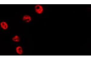 ABIN6278580 staining HepG2 by IF/ICC. (HIST1H2BH antibody  (N-Term))