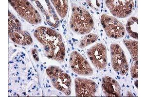 Immunohistochemical staining of paraffin-embedded Human Kidney tissue using anti-SULT1C2 mouse monoclonal antibody. (SULT1C2 antibody)