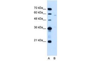 Image no. 1 for anti-Coiled-Coil Domain Containing 112 (CCDC112) (AA 71-120) antibody (ABIN205068) (CCDC112 antibody  (AA 71-120))