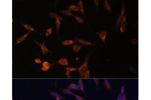 Immunofluorescence analysis of NIH-3T3 cells using UMPS Polyclonal Antibody at dilution of 1:100 (40x lens). (UMPS antibody)