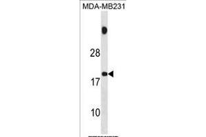 SPNXB Antibody (Center) (ABIN1881824 and ABIN2839075) western blot analysis in MDA-M cell line lysates (35 μg/lane). (SPANXB1 antibody  (AA 17-47))