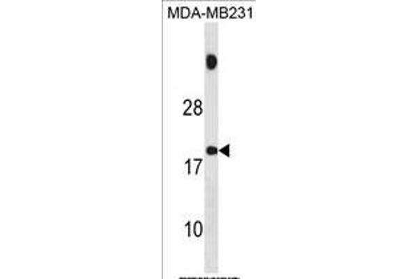 SPANXB1 抗体  (AA 17-47)