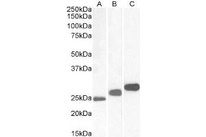 Antibody (0. (CSNK2B antibody  (Internal Region))