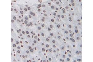 Used in DAB staining on fromalin fixed paraffin- embedded liver tissue (NXF1 antibody  (AA 2-197))