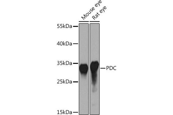 Phosducin antibody  (AA 1-246)