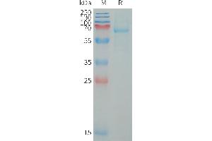 LILRB5 Protein (AA 24-458) (His tag)