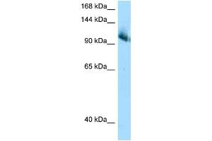 WB Suggested Anti-Cul4b AntibodyTitration: 1. (Cullin 4B antibody  (C-Term))
