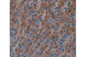 Used in DAB staining on fromalin fixed paraffin- embedded stomach tissue (MATK antibody  (AA 1-173))
