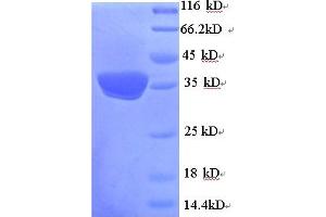 SDS-PAGE (SDS) image for Uncoupling Protein 1 (Mitochondrial, Proton Carrier) (UCP1) (AA 2-307) protein (His tag) (ABIN5713926) (UCP1 Protein (AA 2-307) (His tag))