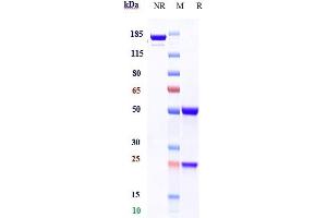 Anti-CD79b Reference Antibody (polatuzumab) on SDS-PAGE under reducing (R) condition. (Recombinant CD79B (Polatuzumab Biosimilar) antibody)