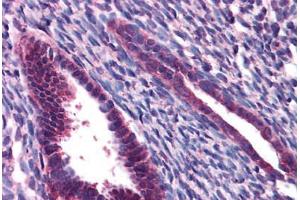 Human Uterus: Formalin-Fixed, Paraffin-Embedded (FFPE) (JMJD1C antibody  (N-Term))