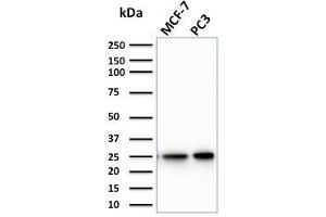 Western Blot Analysis of MCF-7, PC3 cell lysate using CHP2 Mouse Monoclonal Antibody (CPTC-CHP2-1). (Chp2 antibody)