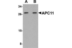 Western blot analysis of APC11 in 3T3 cell tissue lysate with APC11 antibody at (A) 1 and (B) 2 μg/ml. (ANAPC11 antibody  (Center))