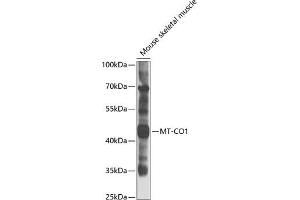 Western blot analysis of extracts of mouse skeletal muscle, using MT-CO1 antibody (ABIN6134141, ABIN6138905, ABIN6138906 and ABIN6223433) at 1:1000 dilution.