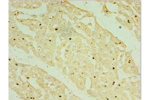 Immunohistochemistry of paraffin-embedded human myocardium tissue using ABIN7155825 at dilution of 1:100 (NK2 Homeobox 5 antibody  (AA 1-135))