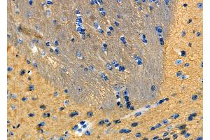 ABIN6265218 and ABIN6277933 at 1/100 staining Mouse brain tissue by IHC-P. (SOD3 antibody  (Internal Region))
