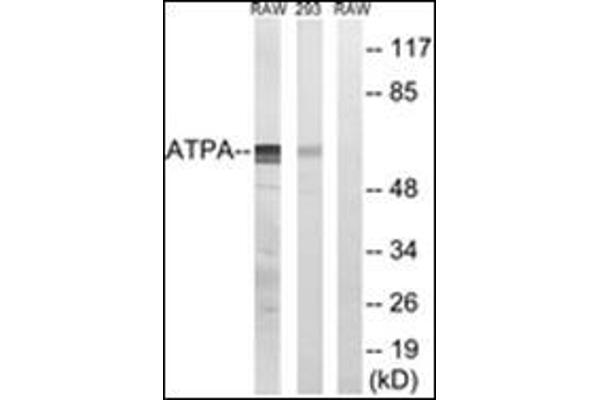 MT-ATP6 抗体  (Subunit alpha)