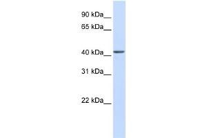 WB Suggested Anti-NOB1 Antibody Titration: 0. (NOB1 antibody  (C-Term))
