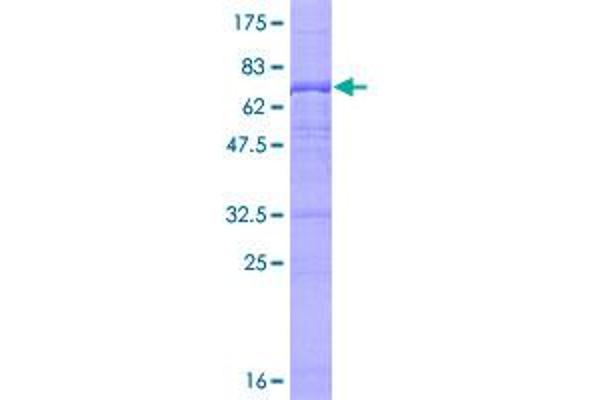 UBE3C Protein (AA 1-404) (GST tag)