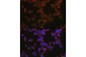 Immunofluorescence analysis of U-937 cells using CD209 Rabbit pAb (ABIN1679076, ABIN5663916, ABIN5663918 and ABIN6218556) at dilution of 1:100 (40x lens). (DC-SIGN/CD209 antibody  (AA 265-404))