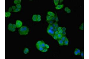 Immunofluorescent analysis of PC-3 cells using ABIN7175296 at dilution of 1:100 and Alexa Fluor 488-congugated AffiniPure Goat Anti-Rabbit IgG(H+L) (VPS26B antibody  (AA 1-336))