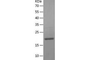 Western Blotting (WB) image for NHP2 Ribonucleoprotein (NHP2) (AA 1-153) protein (His tag) (ABIN7283451) (NHP2 Protein (AA 1-153) (His tag))