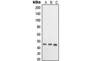 Western blot analysis of RELT expression in HeLa (A), T47D (B), COLO205 (C) whole cell lysates. (RELT antibody  (C-Term))