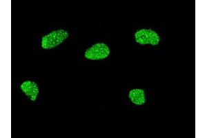 Immunofluorescence of monoclonal antibody to MSX2 on HeLa cell. (Msx2/Hox8 antibody  (AA 101-201))