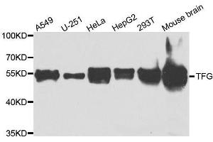 Western blot analysis of extracts of various cell lines, using TFG antibody. (TFG antibody  (AA 1-240))