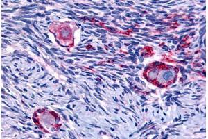 Immunohistochemistry (IHC) image for anti-Nuclear Receptor Subfamily 4, Group A, Member 1 (NR4A1) (N-Term) antibody (ABIN1049160)