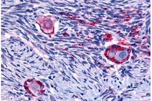Anti-NUR77 antibody  ABIN1049160 IHC staining of human ovary.