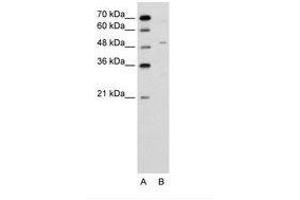 Image no. 1 for anti-Zinc Finger Protein 19 (ZNF19) (AA 51-100) antibody (ABIN6736634) (ZNF19 antibody  (AA 51-100))