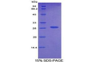 SDS-PAGE (SDS) image for Cystathionine (AA 14-224) protein (His tag) (ABIN1879362)