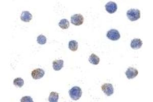 Immunohistochemistry (IHC) image for anti-conserved Helix-Loop-Helix Ubiquitous Kinase (CHUK) antibody (ABIN1030198) (IKK alpha antibody)
