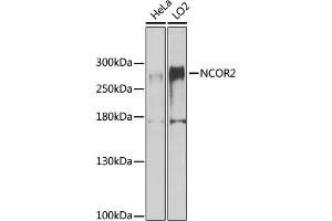 NCOR2 antibody  (AA 670-900)