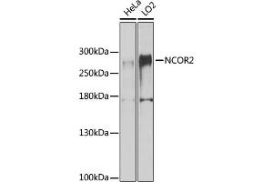 Western blot analysis of extracts of various cell lines, using NCOR2 antibody (ABIN6130575, ABIN6144422, ABIN6144423 and ABIN6224431) at 1:1000 dilution.