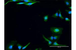 Immunofluorescence of purified MaxPab antibody to USE1 on HeLa cell. (UBE2Z antibody  (AA 1-259))