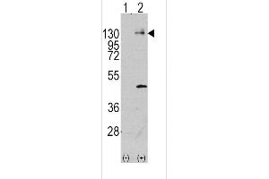 Western blot analysis of PDGFRA using rabbit polyclonal PDGFRA Antibody (Y720) using 293 cell lysates (2 ug/lane) either nontransfected (Lane 1) or transiently transfected with the PDGFRA gene (Lane 2). (PDGFRA antibody  (AA 698-727))